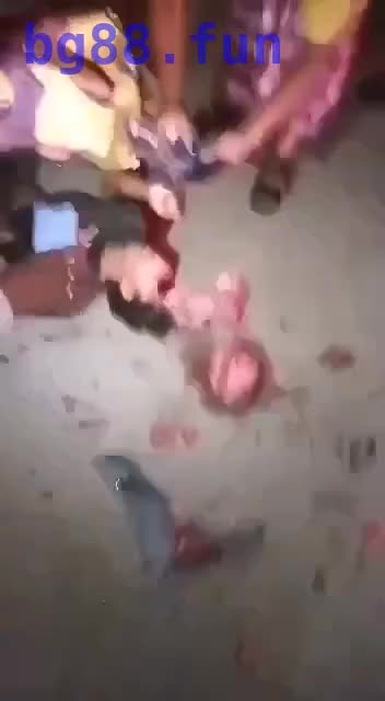 海外男子遇车祸，脑子直接滚落在路边，血腥慎入~ - 第一吃瓜网 chigua.one.mp4