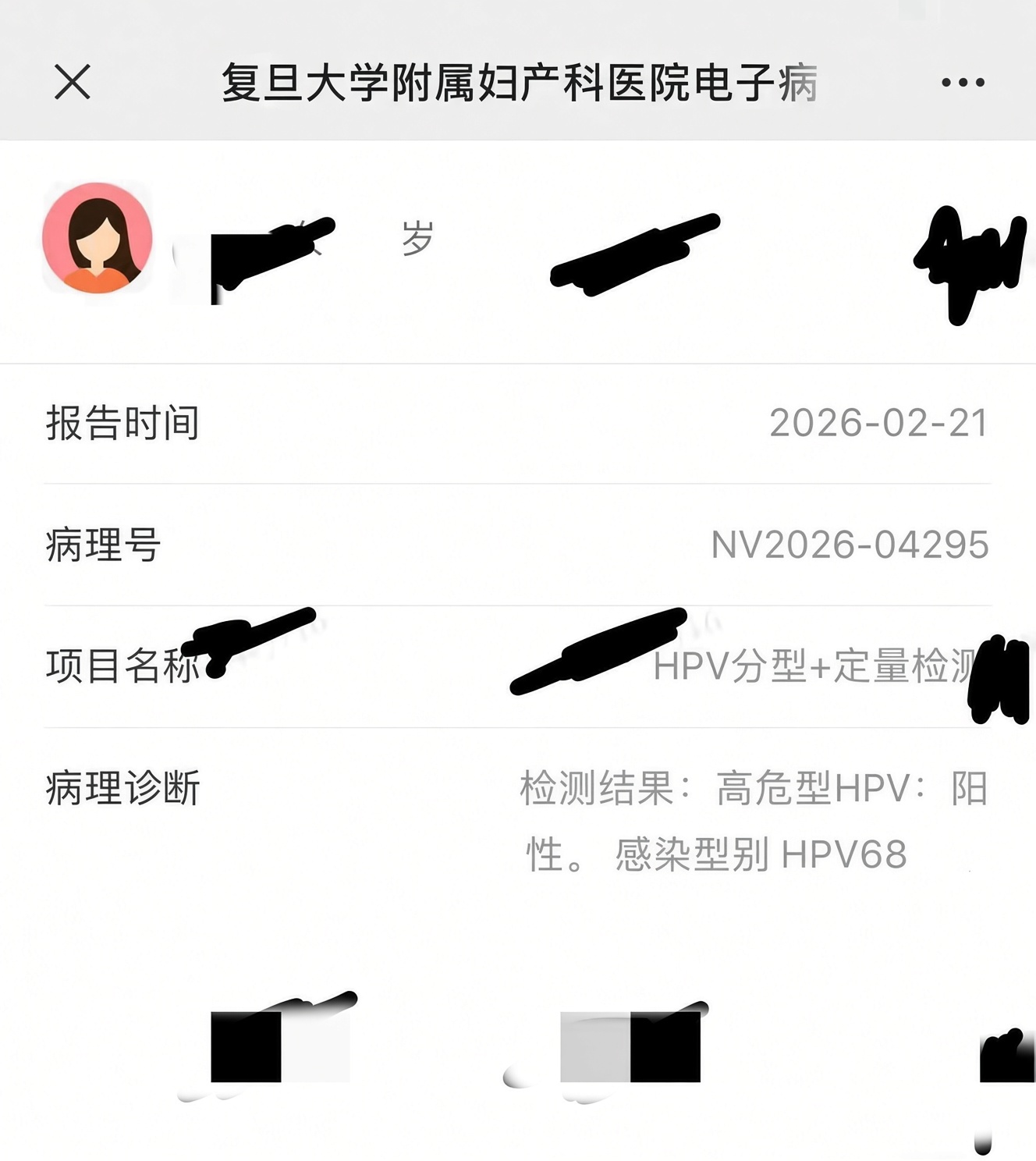 ZZU9U.jpg